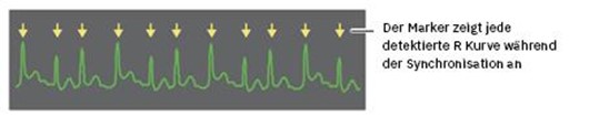 R-Wellen bei den Defibrillatoren der R Serie